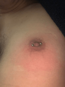 How Do You Know if Your Nipple Piercing is Infected?